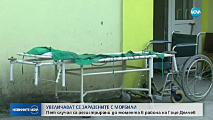 Болните от морбили у нас вече са петима