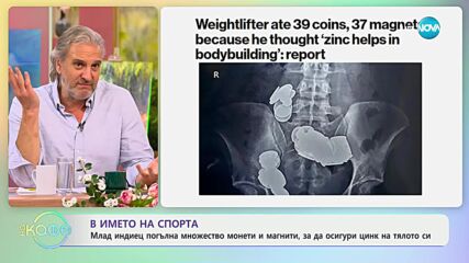 Млад индиец погълна множество монети и магнити, за да осигури цинк за тялото си - „На кафе”