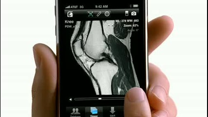 Apple Iphone Commercial Read