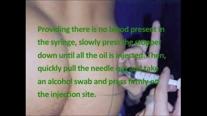 Where To Injected Oil Based -