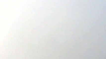Lazer Gozluklen Yakabilir Cekemeyenleri 2018 Hd