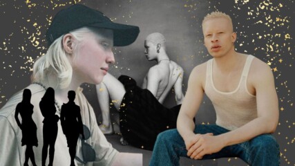 Модели албиноси, които промениха модната индустрия!