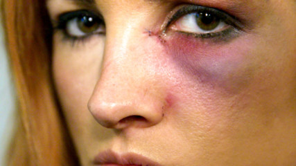 Becky Lynch learns she can't compete at Survivor Series: WWE Day Of
