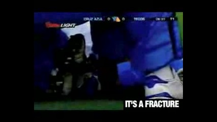 Football Injury Broken Ankle Catflapmag