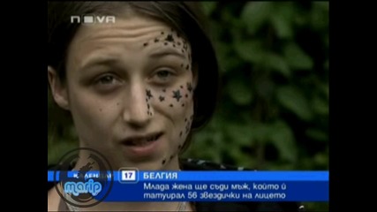 Момиче се сдоби с 56 звездички по лицето