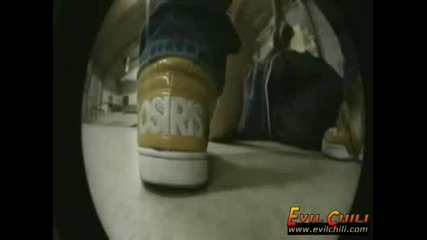 Skater kid breaks his femur