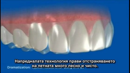 Домашно избелване на зъби - ленти за избелване
