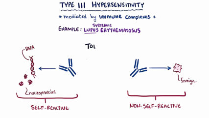 Type Iii hypersensitivity immune complex mediated - causes symptoms pathology