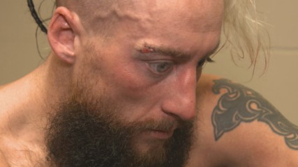 Enzo Amore receives stitches: WWE.com Exclusive, Jan. 8, 2018