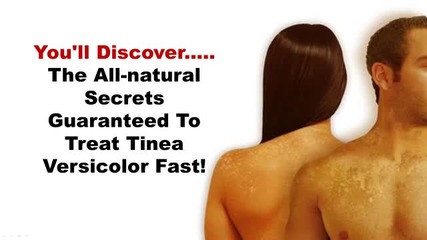 Tinea Flava Treatment