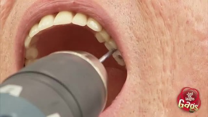 Луд стоматолог - скрита камера