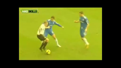 Mad Skills Part 21 