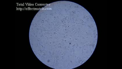 Сперматозоиди Под Микроскоп