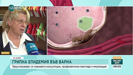 Какви са ограниченията заради грипната епидемия във Варна