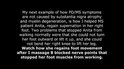 Stopping Parkinson & Ms Symptoms In Seconds By Noel Batten... - Youtube