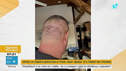 Завързан с белезници и ритан в главата: Мъж твърди, че е жестоко пребит в дискотека в Троян
