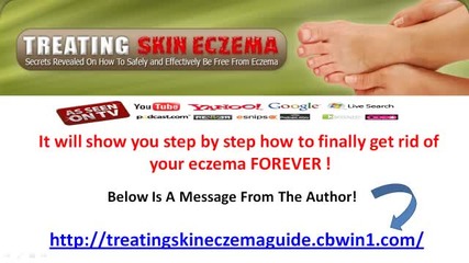 Treating Skin Eczema Guide - Amazing Program