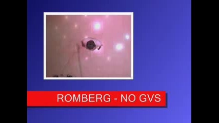 Moore_gvs.wmv