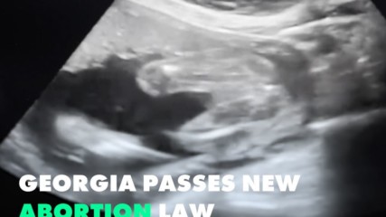 The Controversial 'Heartbeat Abortion' Law