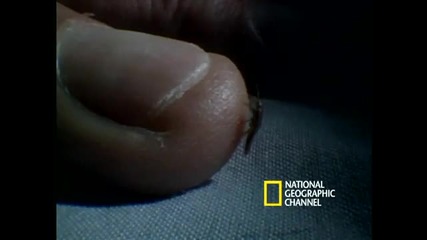 Bed Bugs .. 