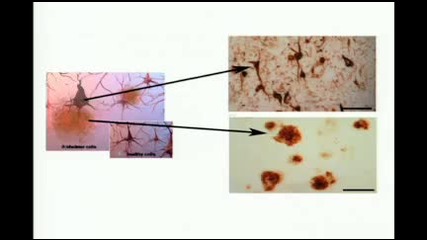 Gregory Petsko The coming neurological epidemic 
