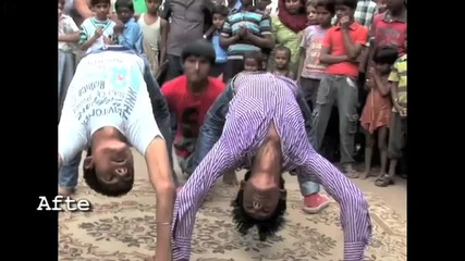 Възхищавам се на такива хора - Legless B-boy Dancer