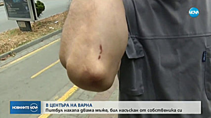 Задържаха собственика на домашното куче, което нахапа двама души в центъра на Варна