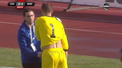 Съмнения за счупена ключица в лагера на Монтана