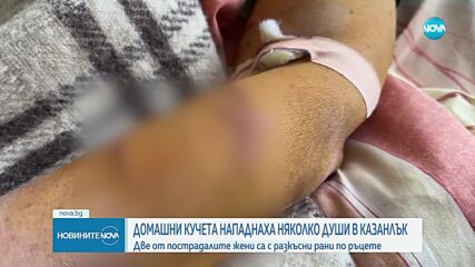 Две жени са в болница, нахапани от кучета в Казанлък