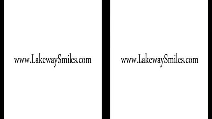 Invisalign Braces Specials in Austin Tx