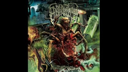 Epicardiectomy - Putreseminal Morphodysplastic Virulency (2014) (full)