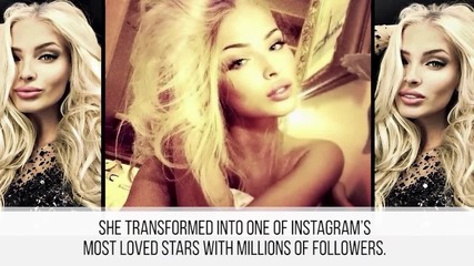 10 Instagram звезди преди пластичните операции!