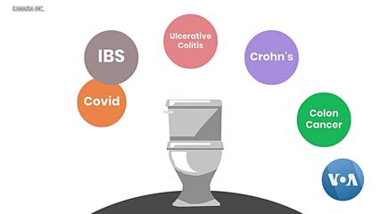 Учени разработиха тоалетни, които ще ни предупреждават за болести и лоши хранителни навици
