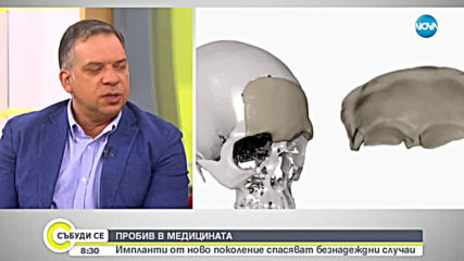 3D импланти от ново поколение спасяват безнадеждни случаи