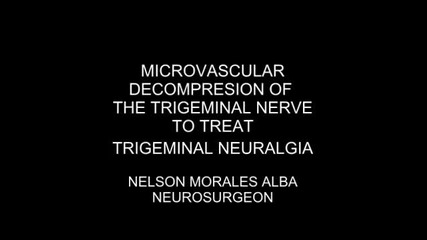 Неврохирургия - декомпресия на N. Trigeminus 