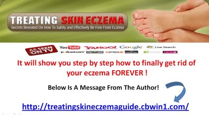 Treating Eczema on Face at Home