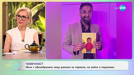 Мъж с обезобразено лице разказа за тормоза, на който е подложен - „На кафе“ (21.05.2025)