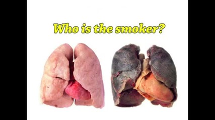последствията от пушенето!