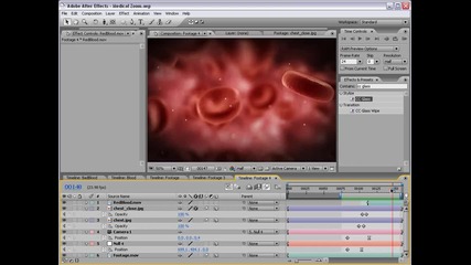 Adobe After Effects - Medical Zoom 03