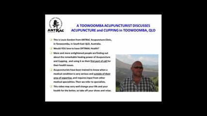 A Toowoomba Acupuncturist Discusses Acupuncture and Cupping in Toowoomba Qld