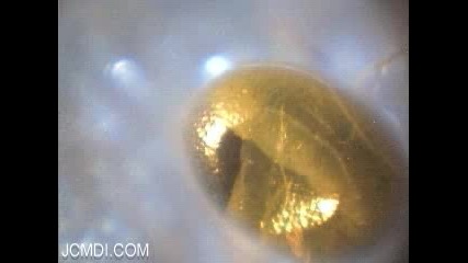 Time - lapse Sphinx moth egg hatches under microscope 