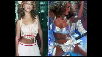 Beyonce Plastic Surgery 1 -
