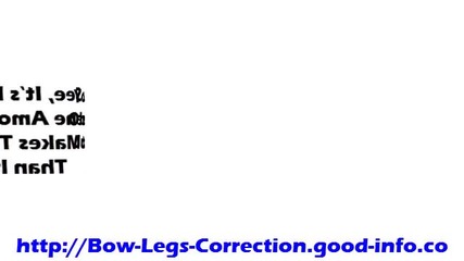 Bowlegged, Bow Legs In Adults, Knock Knee Treatment For Adults, Knock Knee Surgery Adults