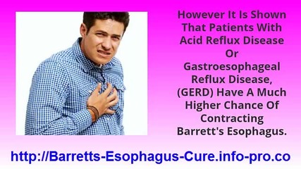 Icd 9 Code Barrett's Esophagus, Barrett's Esophagus Low Grade Dysplasia, Barrett's Esophagus Ulcer