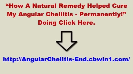 Cheilitis, Angular Cheilitis Remedy, Angular Cheilitis Medicine, Causes Of Cheilitis