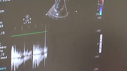 Тази неделя от 11 ч. в "Пулс" ще видите