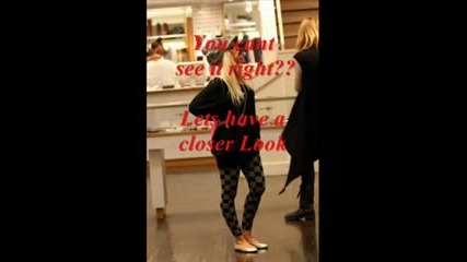 Christina Aguilera пак с разширена уста