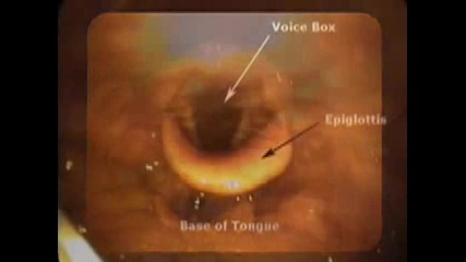Anatomical Tutorial During Trans - Nasal Endoscopy