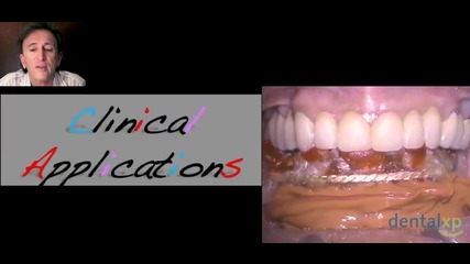 Henry Salama Immediate Loading in Implant Dentistry