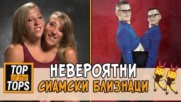 ТОП 5 на най-интересните истории за сиамски близнаци